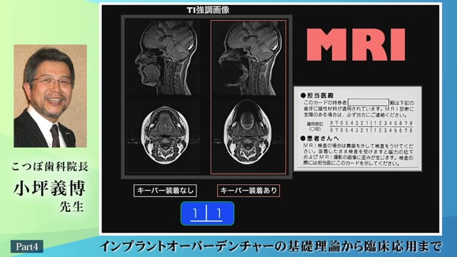 #4 MRIについて