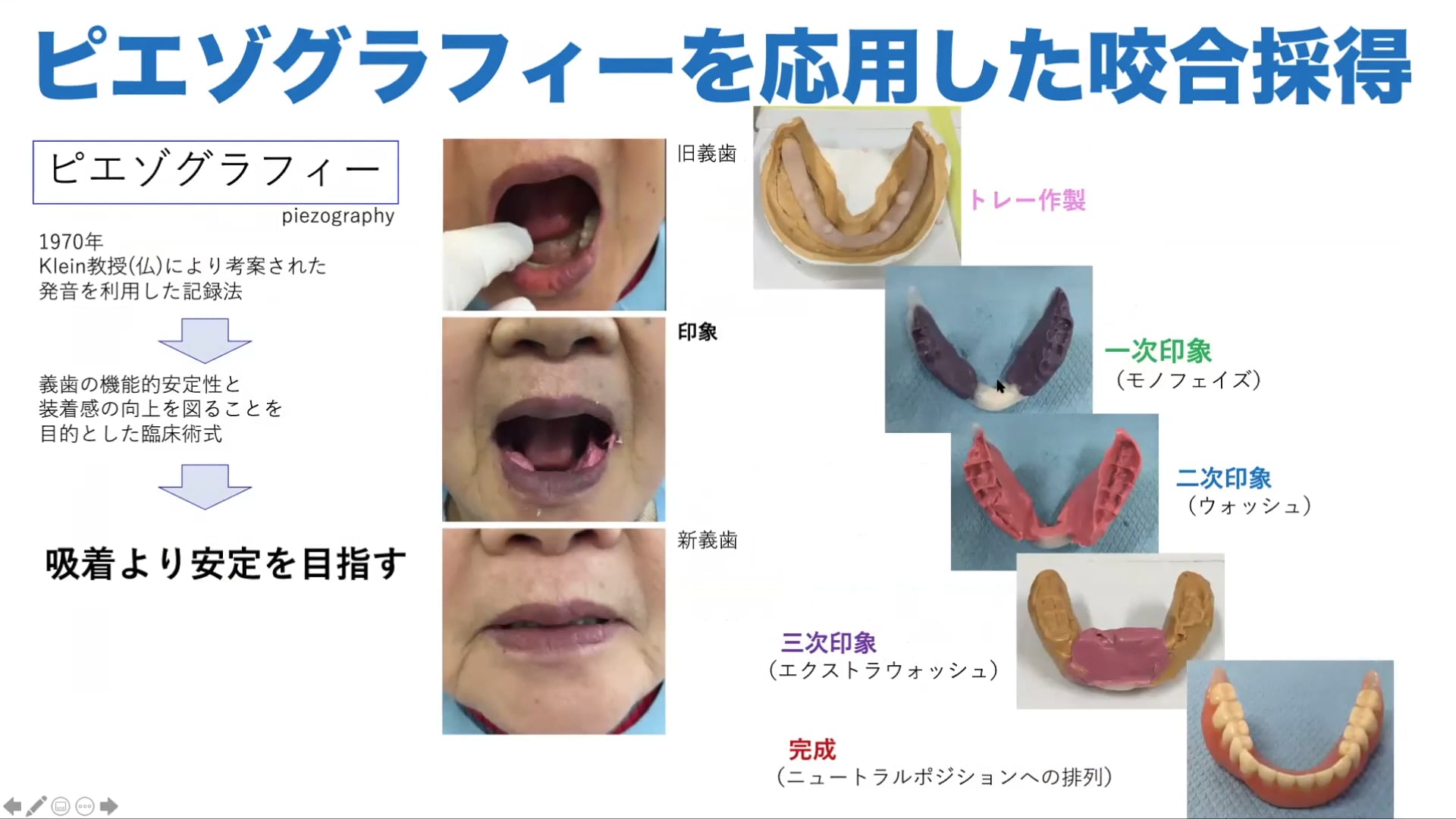 Denture Cafe 第11回 咬合高径の決め方 失われた顎間距離を再決定する難題に挑む Doctorbook Academy