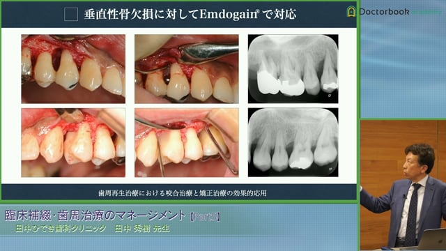 臨床補綴・歯周治療のマネージメント | Doctorbook academy (ドクター