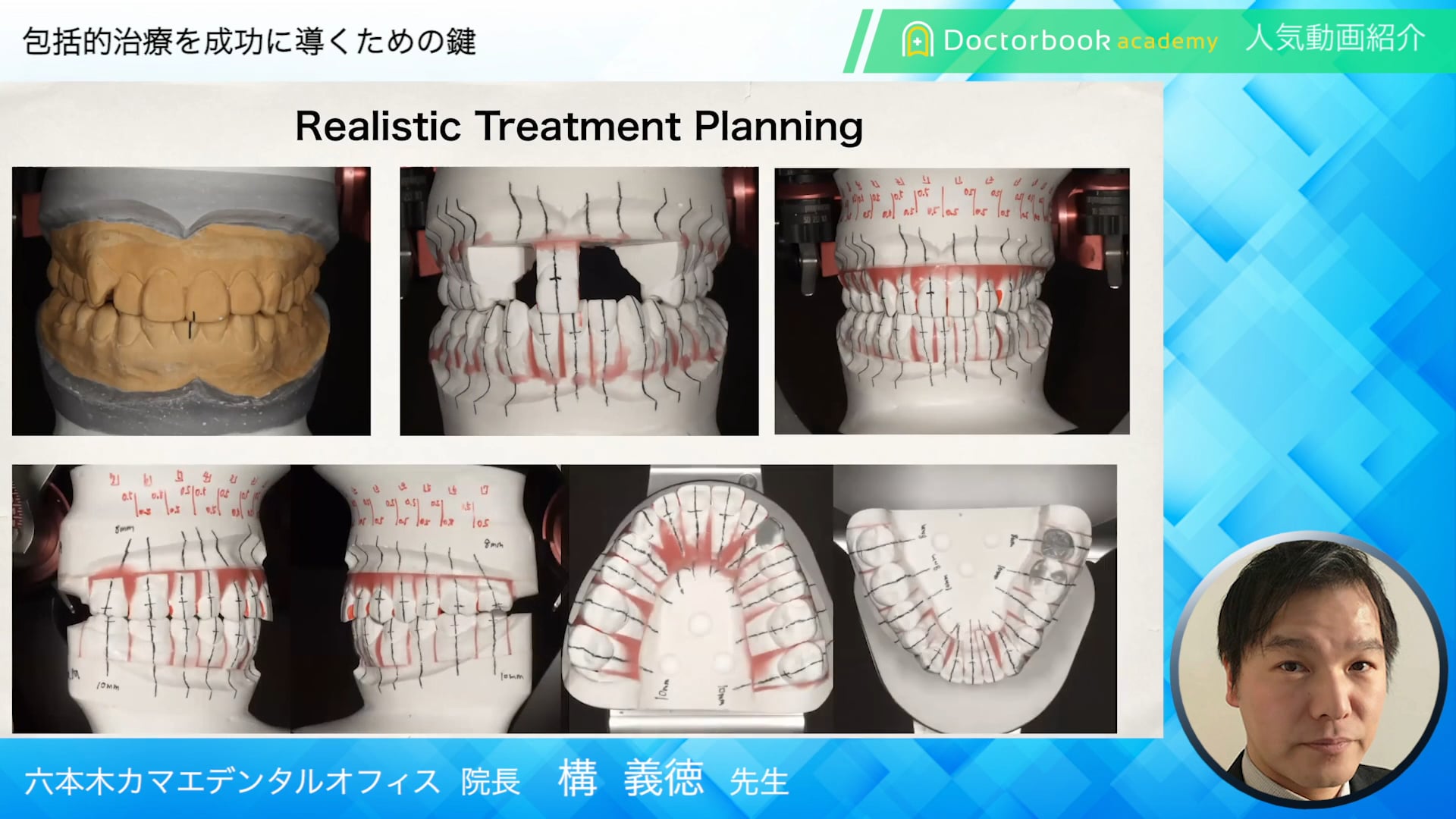 【Doctorbook academy 人気動画紹介】包括的治療を成功に導くための鍵