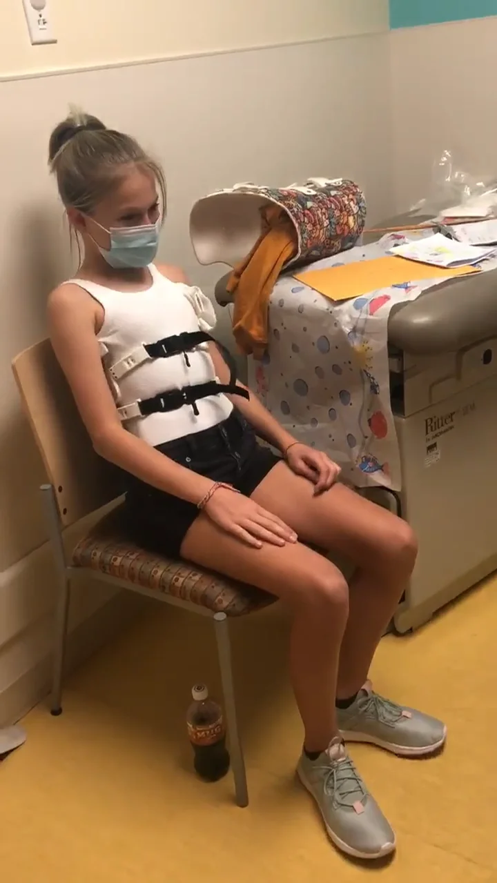 حزام اعوجاج العمود الفقري