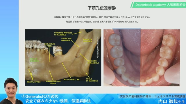 【Doctorbook academy 人気動画紹介】④Generalistのための安全で痛みの少ない浸潤、伝達麻酔法