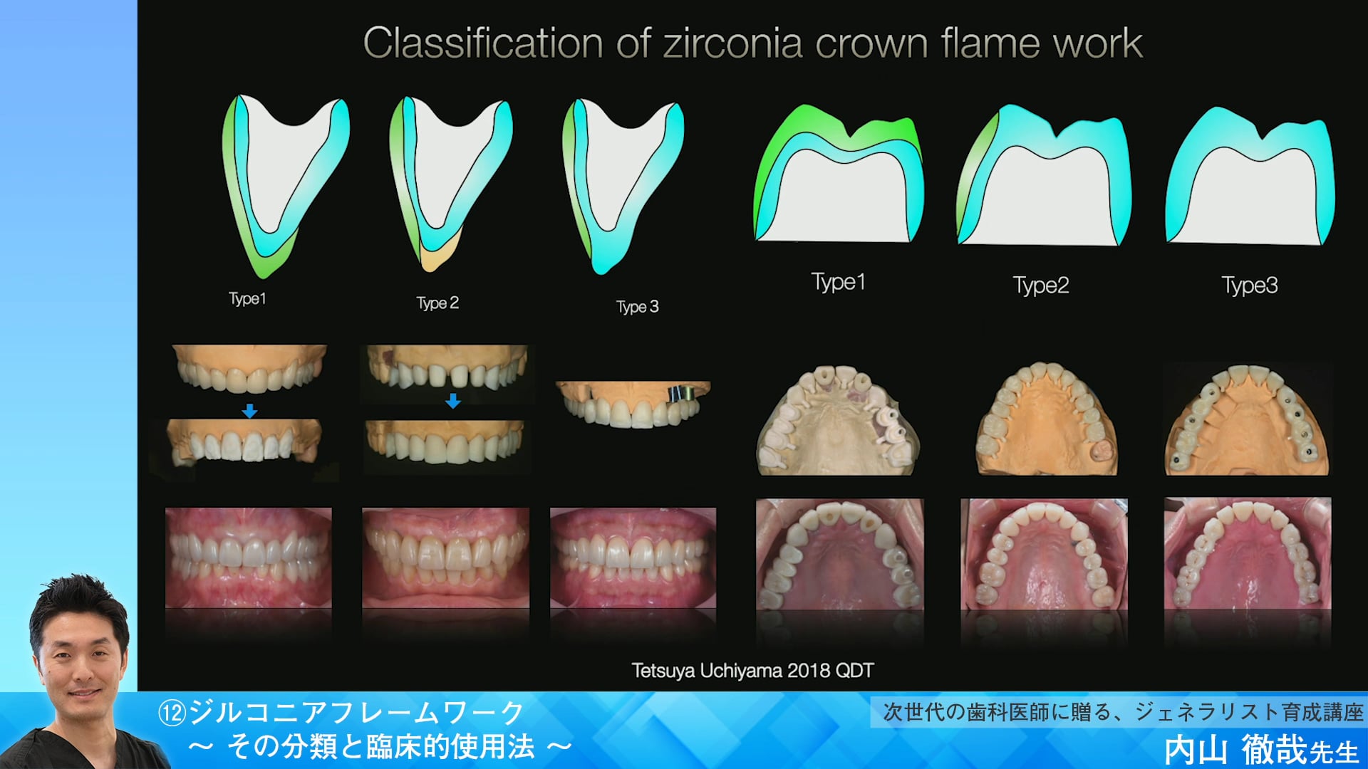 最も完璧な [A12270234]1から学ぶジルコニア臨床: エキスパートが教える選び方・使い方のコツ 臨床医学 -  www.espace-sos-canin.fr