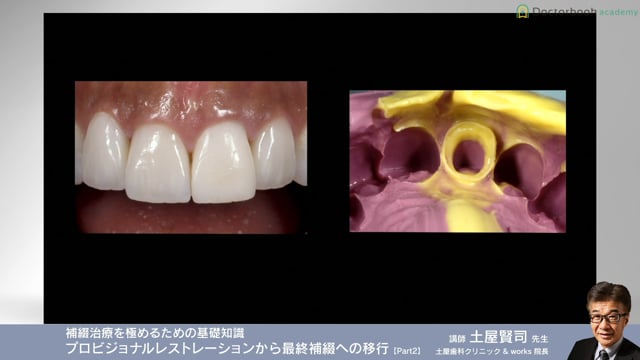 #2 opacity vs translucency