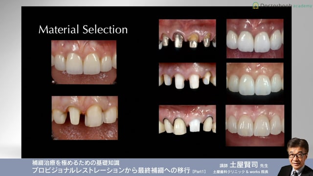 #1 gingival color