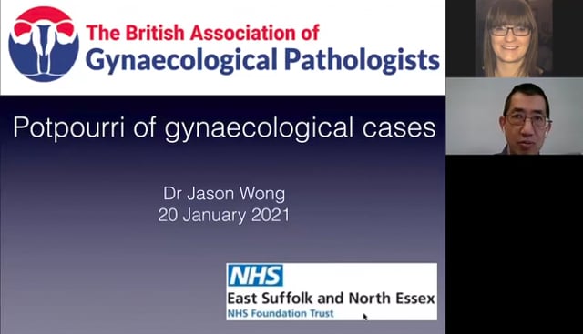 Potpourri of Gynaecological cases