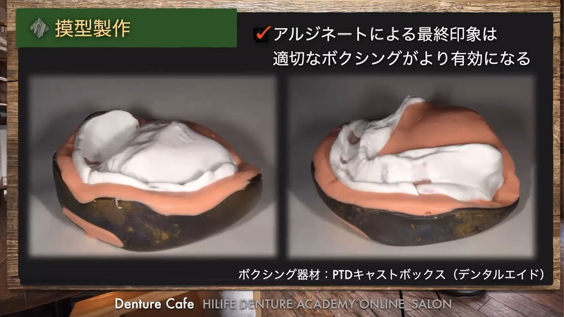 #2 Denture Cafe 第13回「総義歯の最終印象をアルジネートで成功させる！」