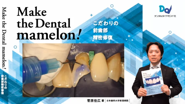 Make the Dental mamelon！～こだわりの前歯部精密修復～ 【著】菅原佳広（日本歯科大学新潟病院）