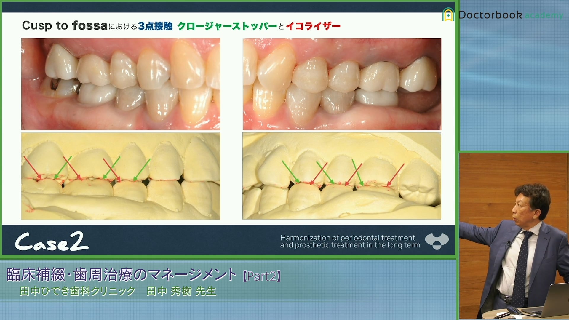 臨床 歯周補綴2 マニュアル&クリニック 第一歯科出版 - 健康/医学