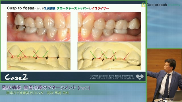 臨床補綴・歯周治療のマネージメント | Doctorbook academy (ドクター