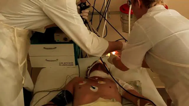 Бронхоскопия трахеобронхоскопия. Бронхоскопия трахеобронхоскопия. Как делают бронхоскопию видео. Бронхоскопия трахеобронхоскопия. Бронхоскопия бимодальная.