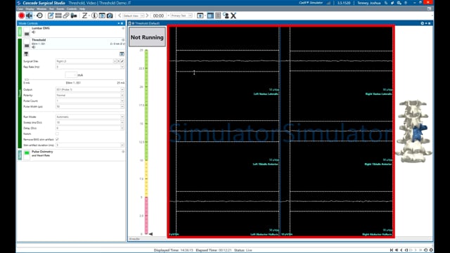Automatic Threshold Mode