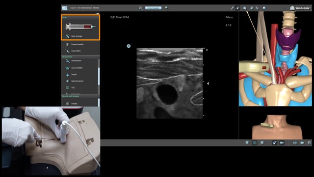 Central Line Ultrasound Module - Surgical Science