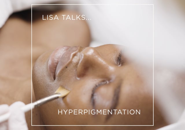 Lisa Talks... Hyperpigmentation