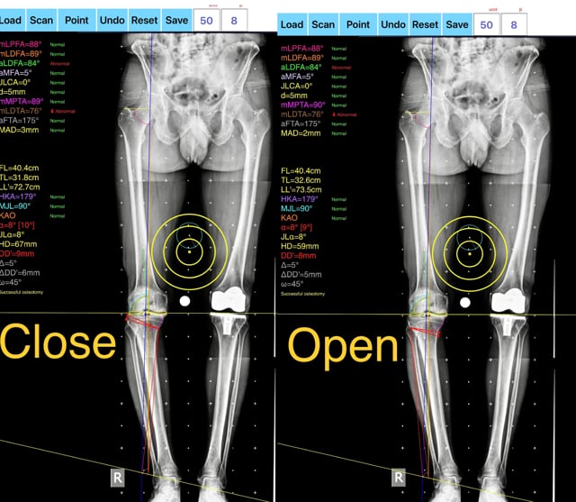 orthopaedic medical apps on Vimeo