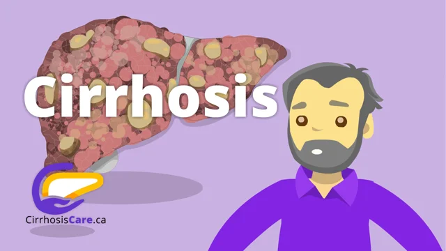 Living with Cirrhosis