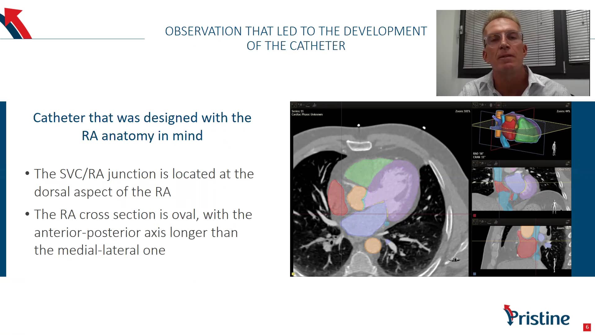 Tal, Michael_INITIAL CLINICAL EXPERIENCE WITH A SYMMETRIC TIP TUNNELED