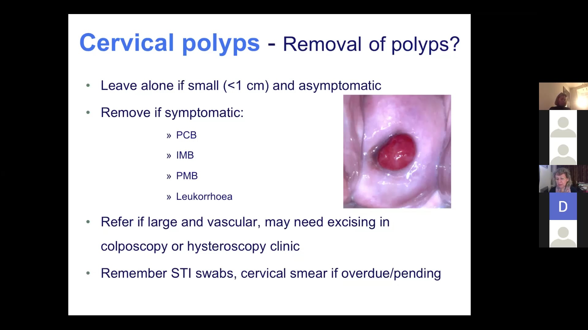 cervical-polyp-training-hrt-webinar-discussion-on-vimeo