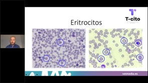 El frotis sanguíneo - Morfología de las células