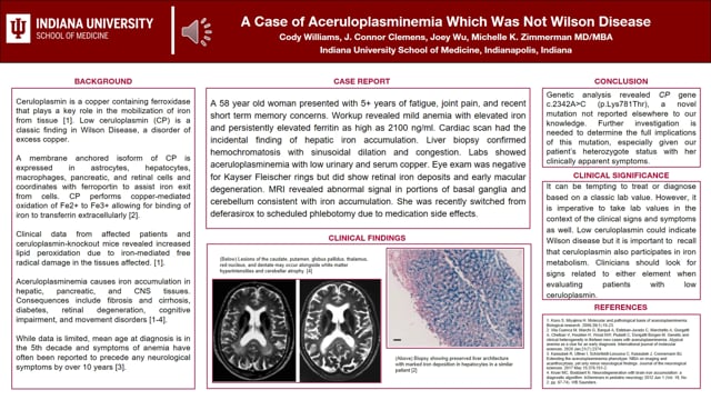 M85-A Case of Aceruloplasminemia Which Was Not Wilson Disease