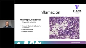 Inflamación vs Neoplasia en citología