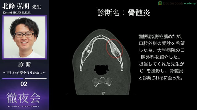 #2 失活歯の診断