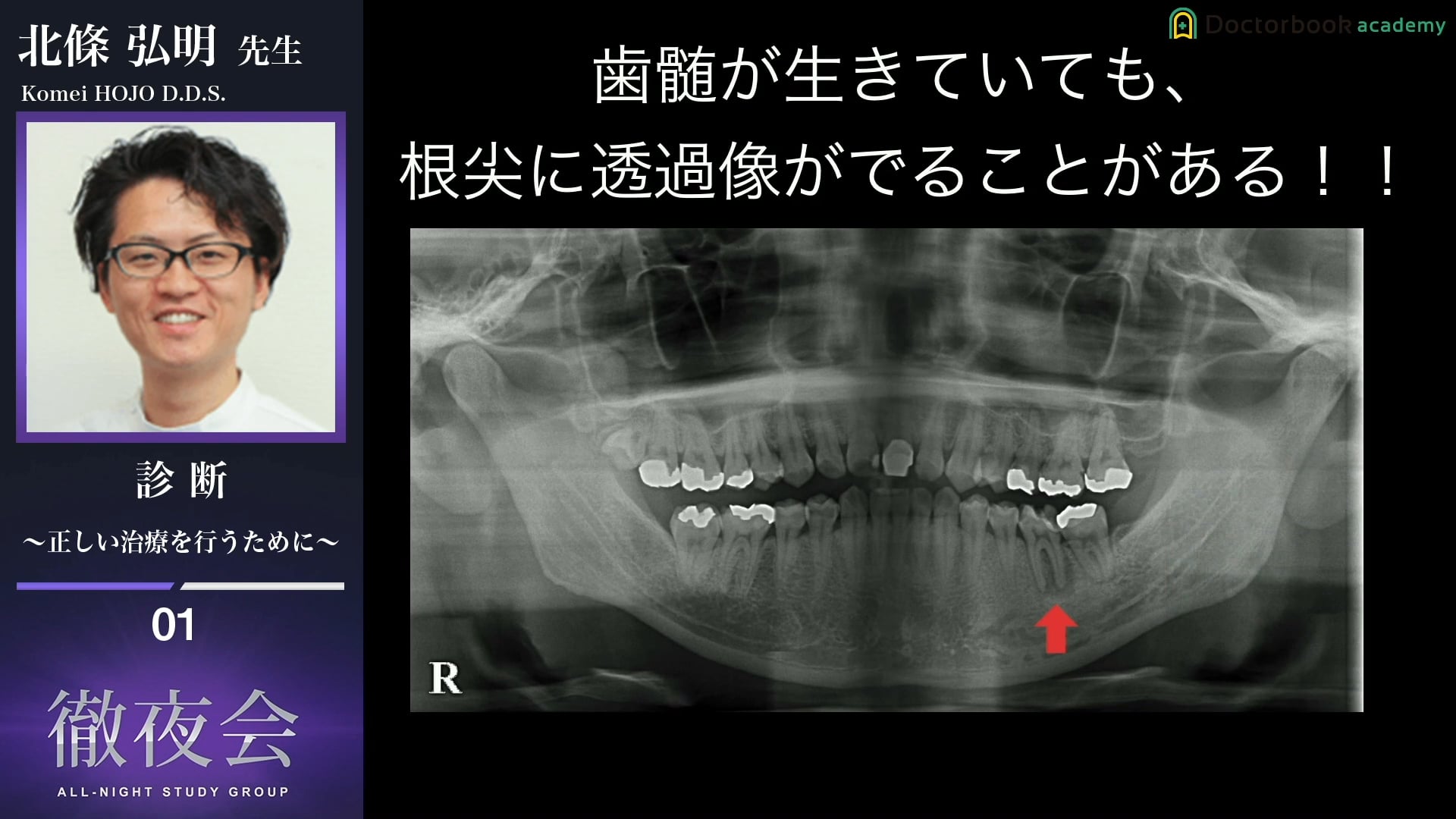 #1 あらゆる可能性を考える重要性