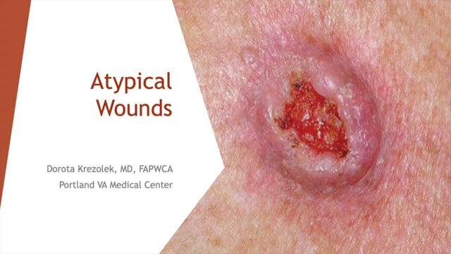 3. Dorota Krezolek - Atypical Wounds