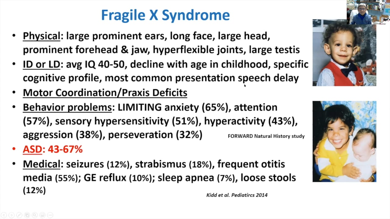 SFARI | Clinical trials and cyclic AMP in fragile X syndrome: A life journey