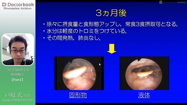 今こそ知りたい！ 摂食嚥下