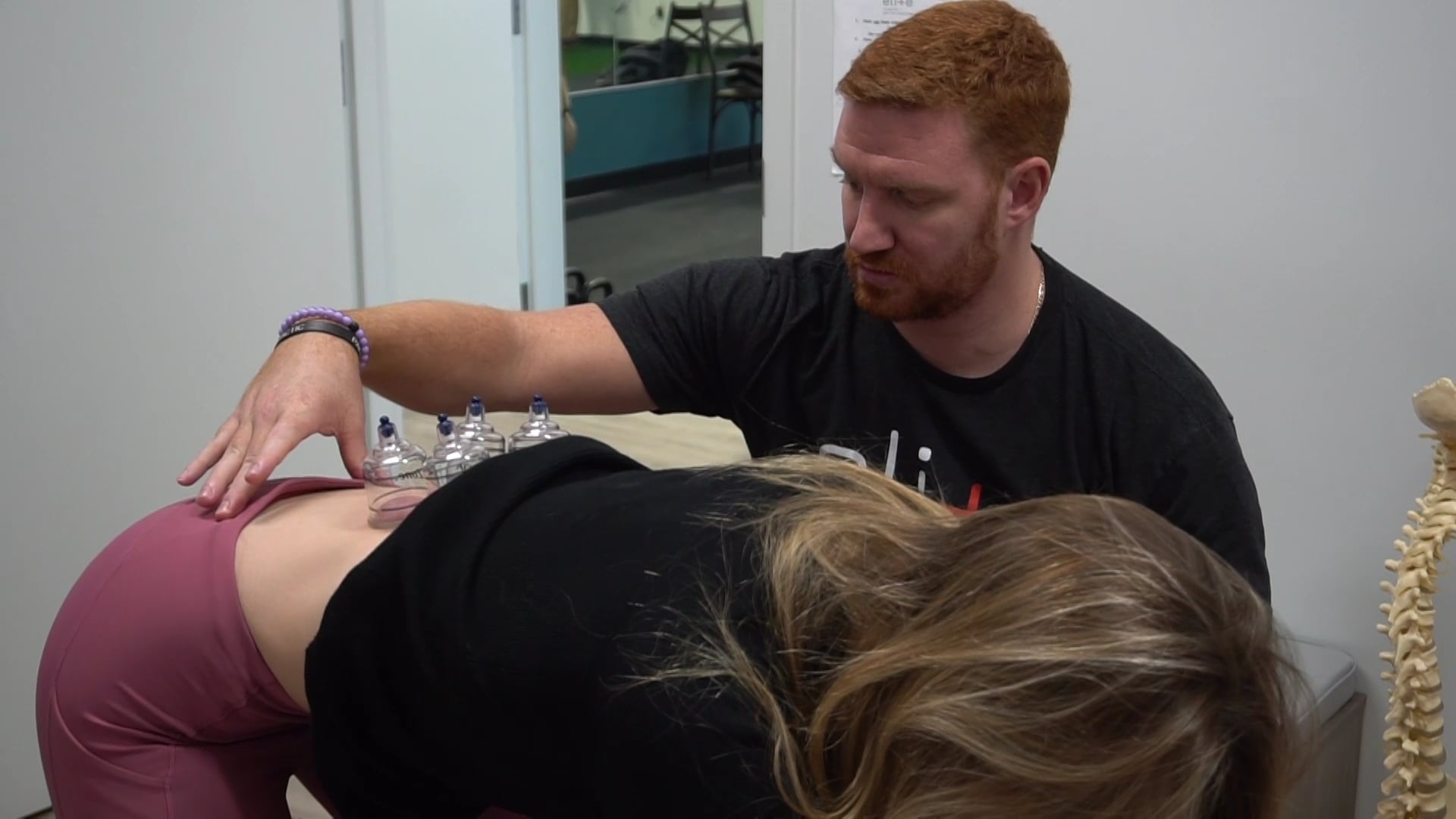 Getting Back on the Court with Cupping | Elite Health + Performance