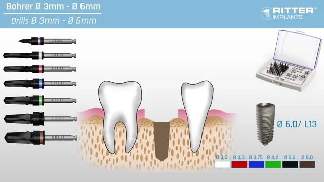 Ritter Implants videos-and-tutorials