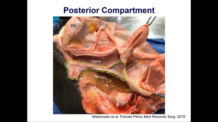 Pelvic Anatomy