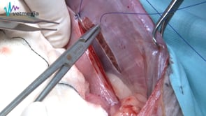 Colopexia para hernia perineal
