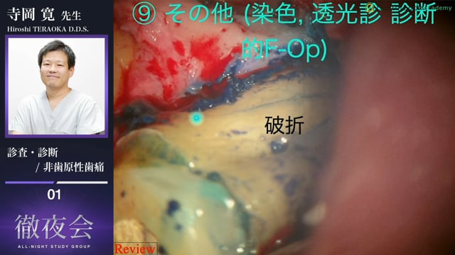 診査・診断 / 非歯原性歯痛
