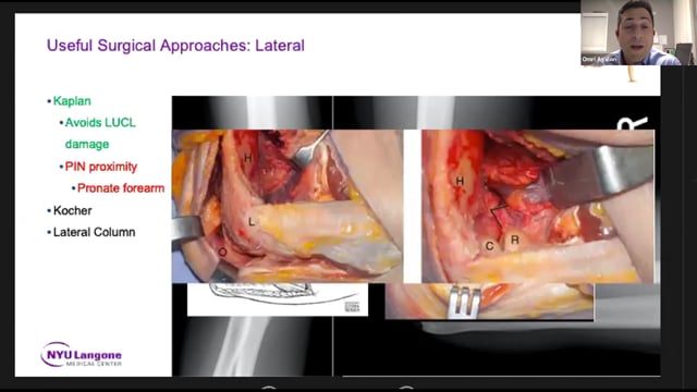 Elbow Trauma – Relevant Anatomy and Useful Surgical Approaches