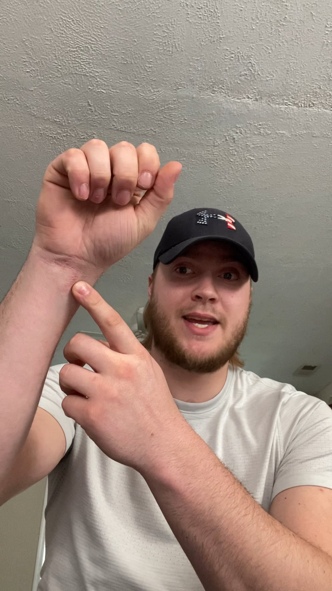 Arm Injuries in Young Adults Video.mov on Vimeo