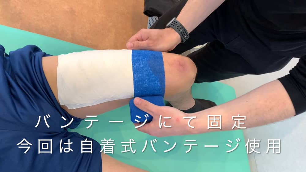 野球選手のための肉離れテーピング方法 野坂光陽 Note