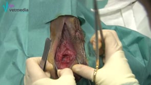 Hernia perineal (transposición del obturador interno)