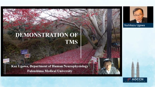 Demonstration of TMS