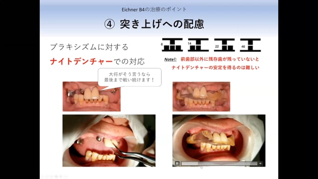 都内で パソコン一般 [A11234215]前歯部審美修復 天然歯編 ...