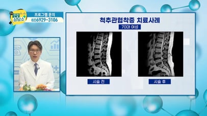 [TVA+ TV건강상담소] 공성주 대표원장 출연