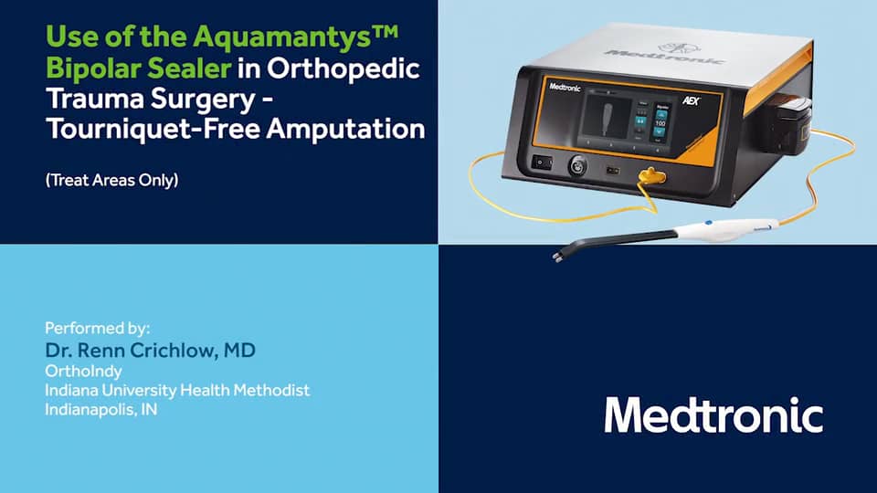 Crichlow Use of the Aquamantys Bipolar Sealer During Orthopedic Trauma