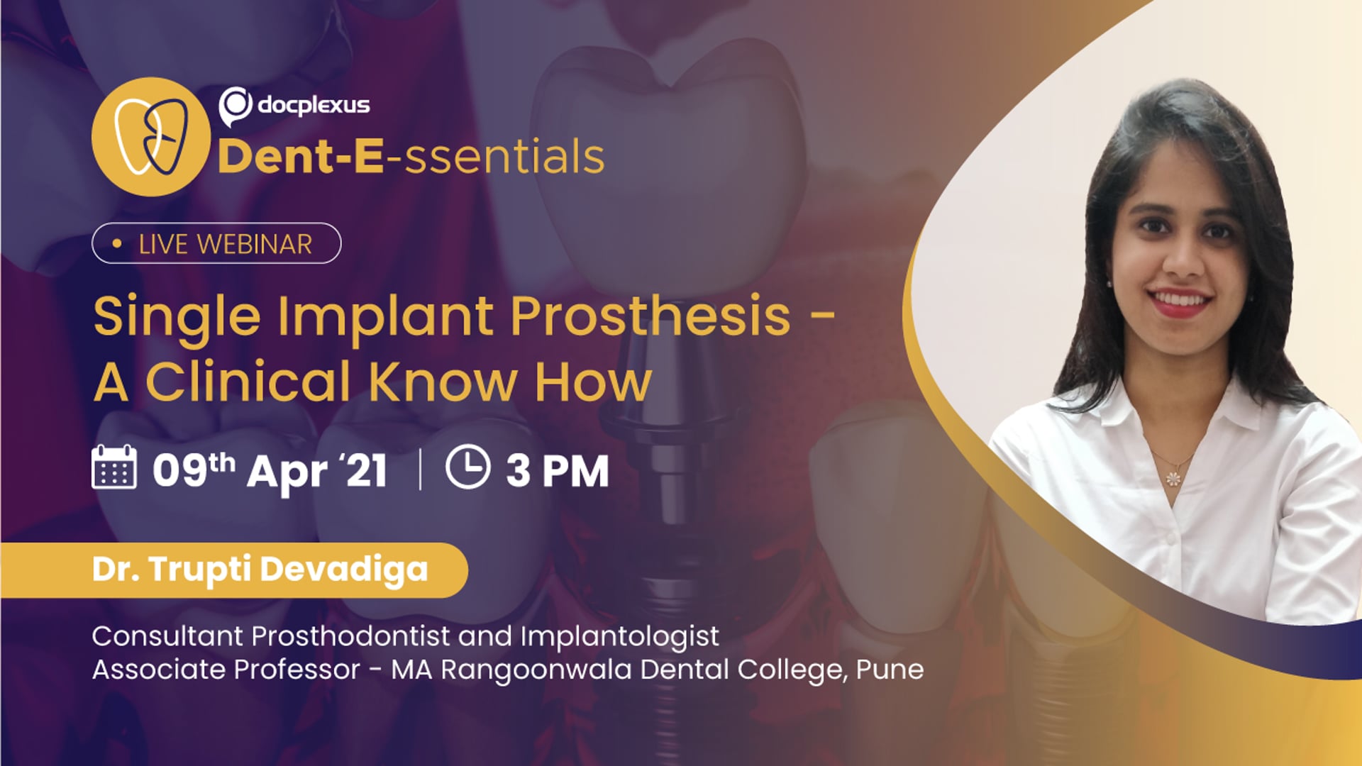 Single Implant Prosthesis - A Clinical Know How