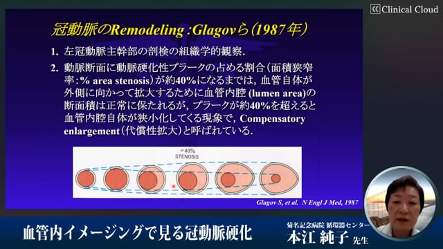 本江 純子 血管内イメージングで見る冠動脈硬化 Clinical Cloud By Medipal