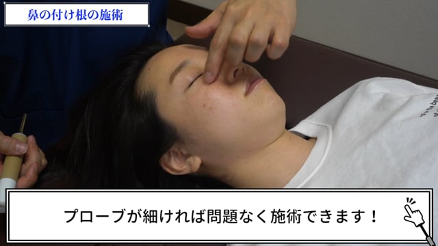 小顔矯正〜目・鼻編〜
