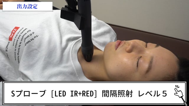 星状神経節ブロック照射