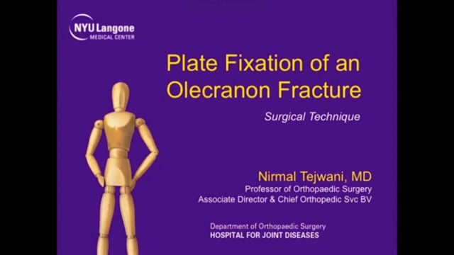 Plate Fixation of an Olecranon Fracture