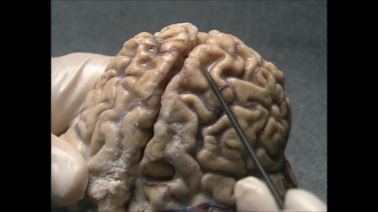real human brain pictures