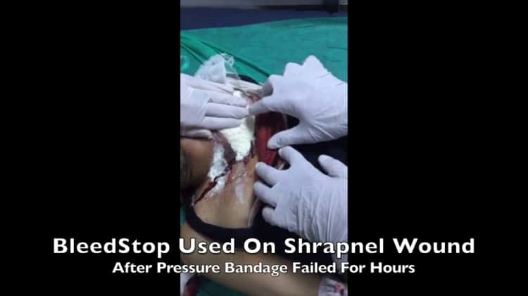 pressure bandage for bleeding